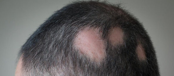 dermatologista em Florianopolis sc square Dermatologista em Florianópolis – Norte da Ilha