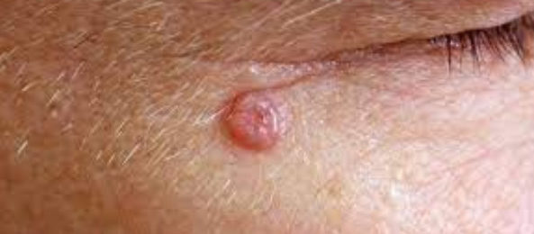 dermatologista em Florianopolis sc square Dermatologista em Florianópolis – Norte da Ilha