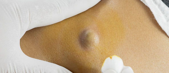 dermatologista em Florianopolis sc square Dermatologista em Florianópolis – Norte da Ilha